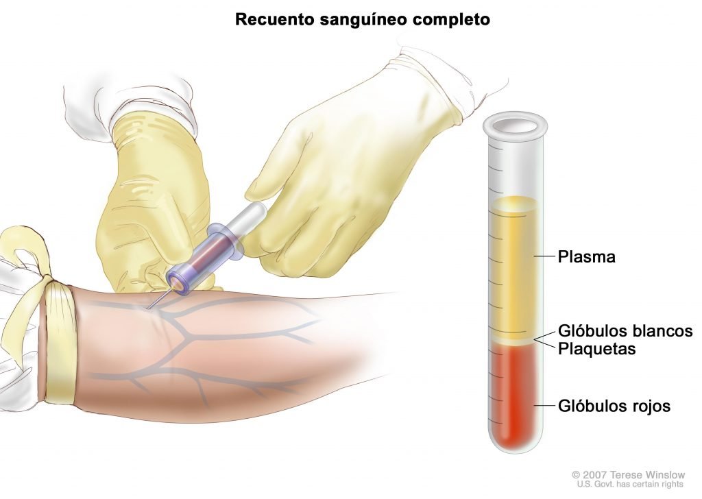 hematologo en cancun2