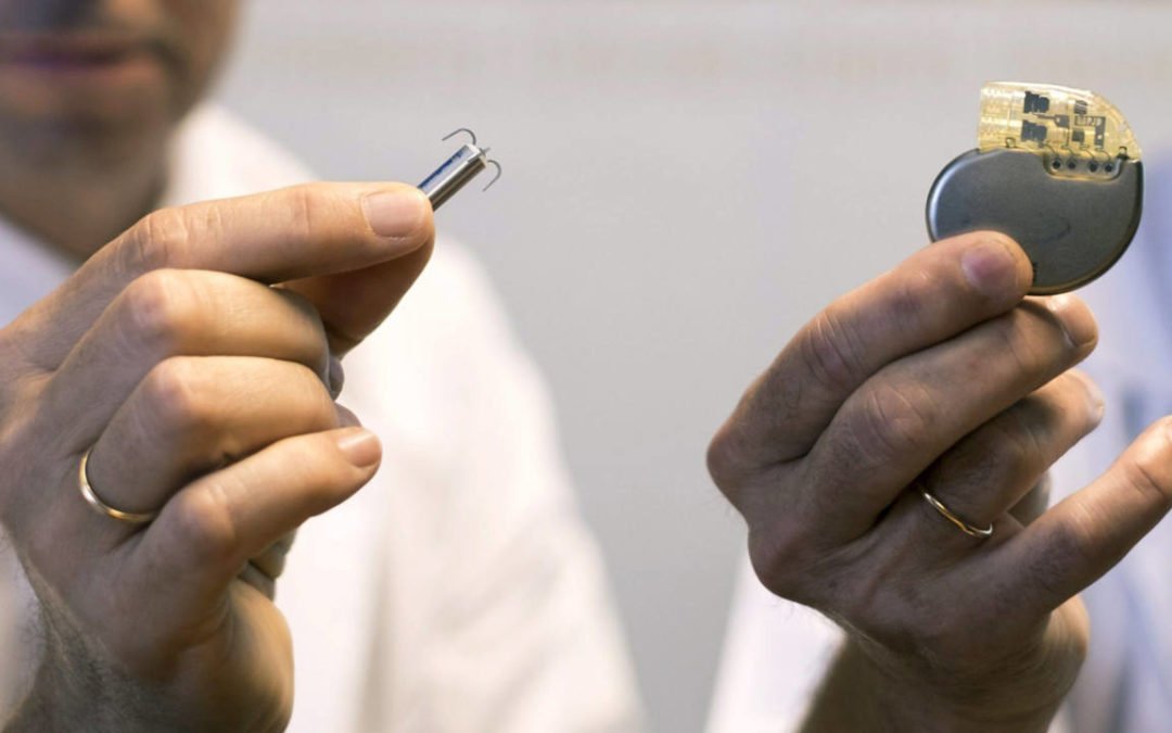 Marcapasos “micra”: el más pequeño del mundo, sin cables y sin cirugía
