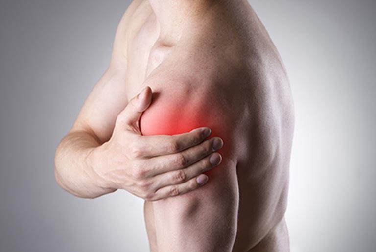 ¿Cuáles son las causas de los dolores musculares?